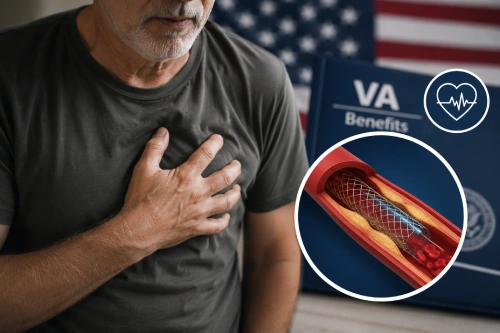 VA Disability Rating for Heart Stent Veteran